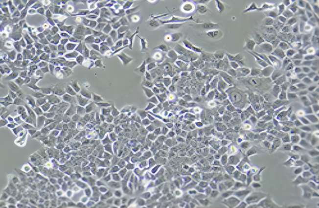 人结肠癌细胞HCT116​​