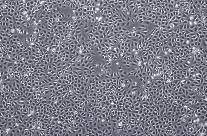 人宫颈癌细胞-HeLa​细胞