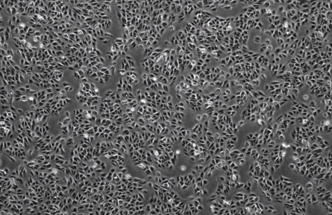 人视网膜色素上皮细胞 ARPE19