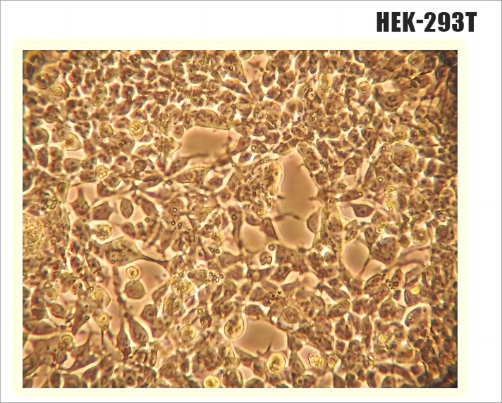 在<i style='color:red'>hek293</i>细胞系中表达蛋白的方法步骤和经验分享