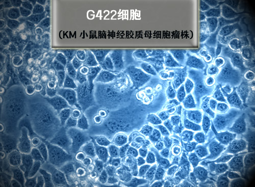 KM小鼠脑<i style='color:red'>神经胶质母细胞瘤</i>瘤株 G422