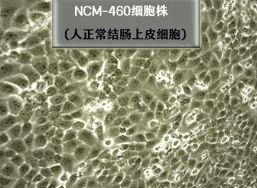 NCM460细胞