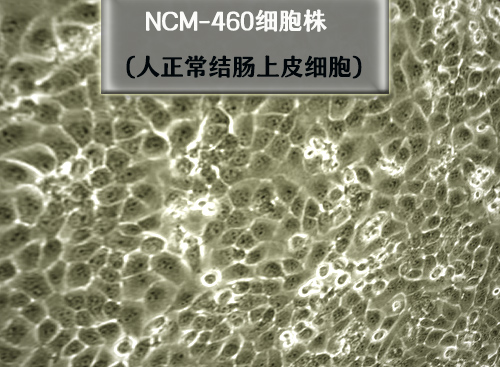 NCM-460细胞