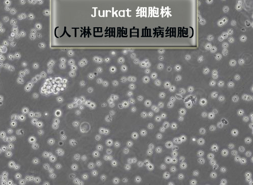 Jurka-t细胞