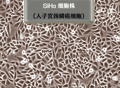 SiHa细胞