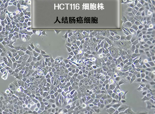 人结肠癌细胞HCT116​​