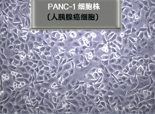 人胰腺癌细胞PANc-1