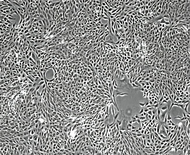 Vero细胞株​-非洲绿猴肾细胞​
