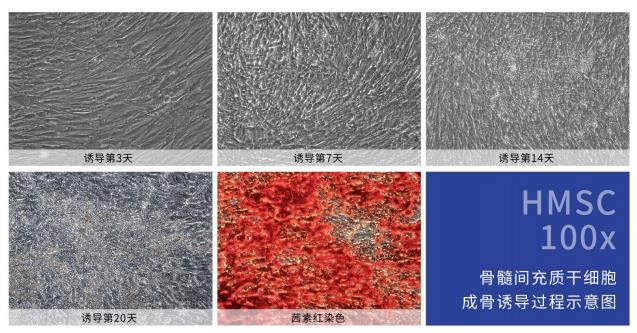 成骨干细胞诱导分化示意图