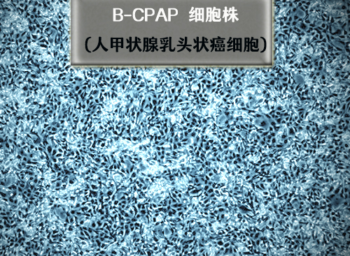 B-CPAP细胞