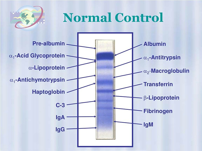 蛋白质印迹技术（Western Blot）的基本流程和步骤