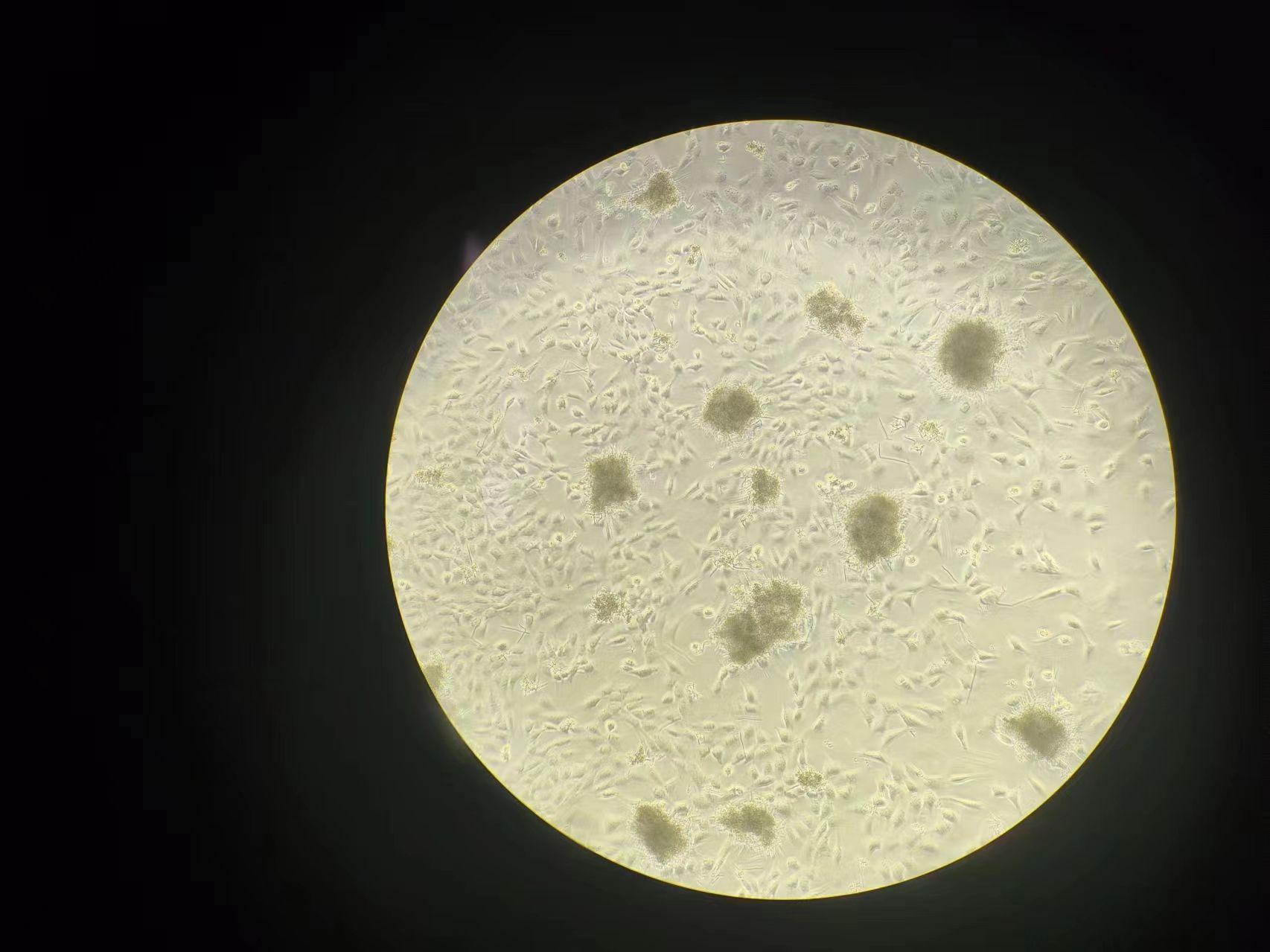 minigene 构建时,成纤维细胞和角质形成细胞培养条件有哪些不同？