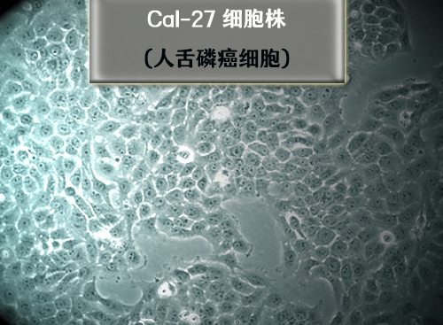 Cal-27细胞